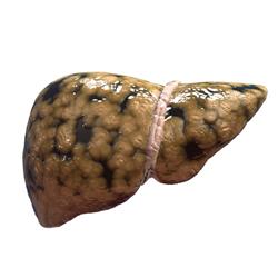 fatty liver- شکرانه سلامت آقای شوشو